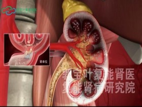 治肾病越早进行科学的干预和病理治疗越好