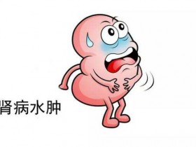 肾衰竭会危及生命吗?